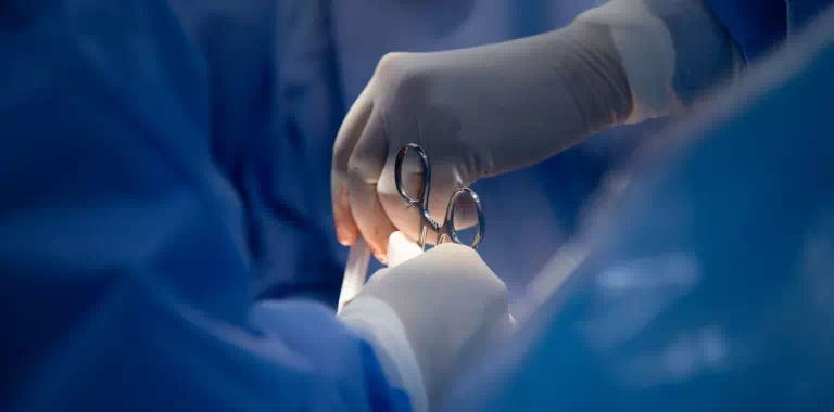 kleszcze chirurgiczne w dłoniach