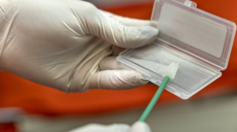 przyrząd do badania cytologicznego