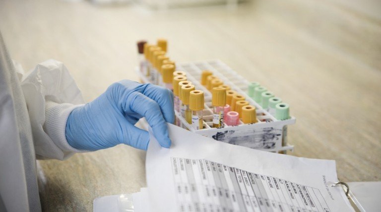 probówki w laboratorium medycznym